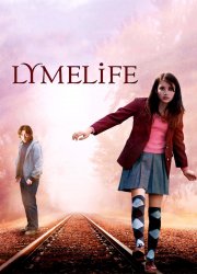 Watch Lymelife